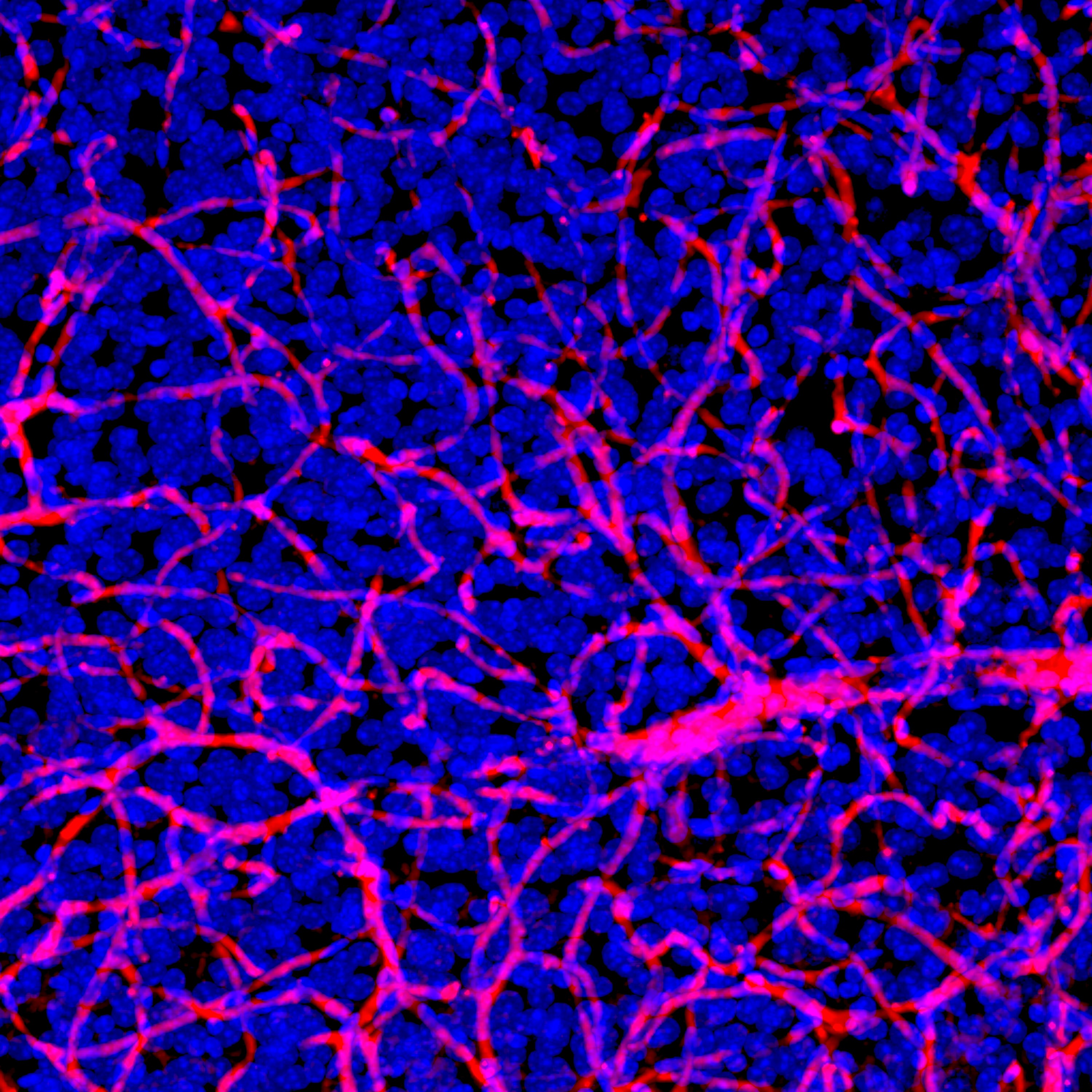 Blood brain barrier from mouse brain tissue. Image provided by the National Cancer Institute