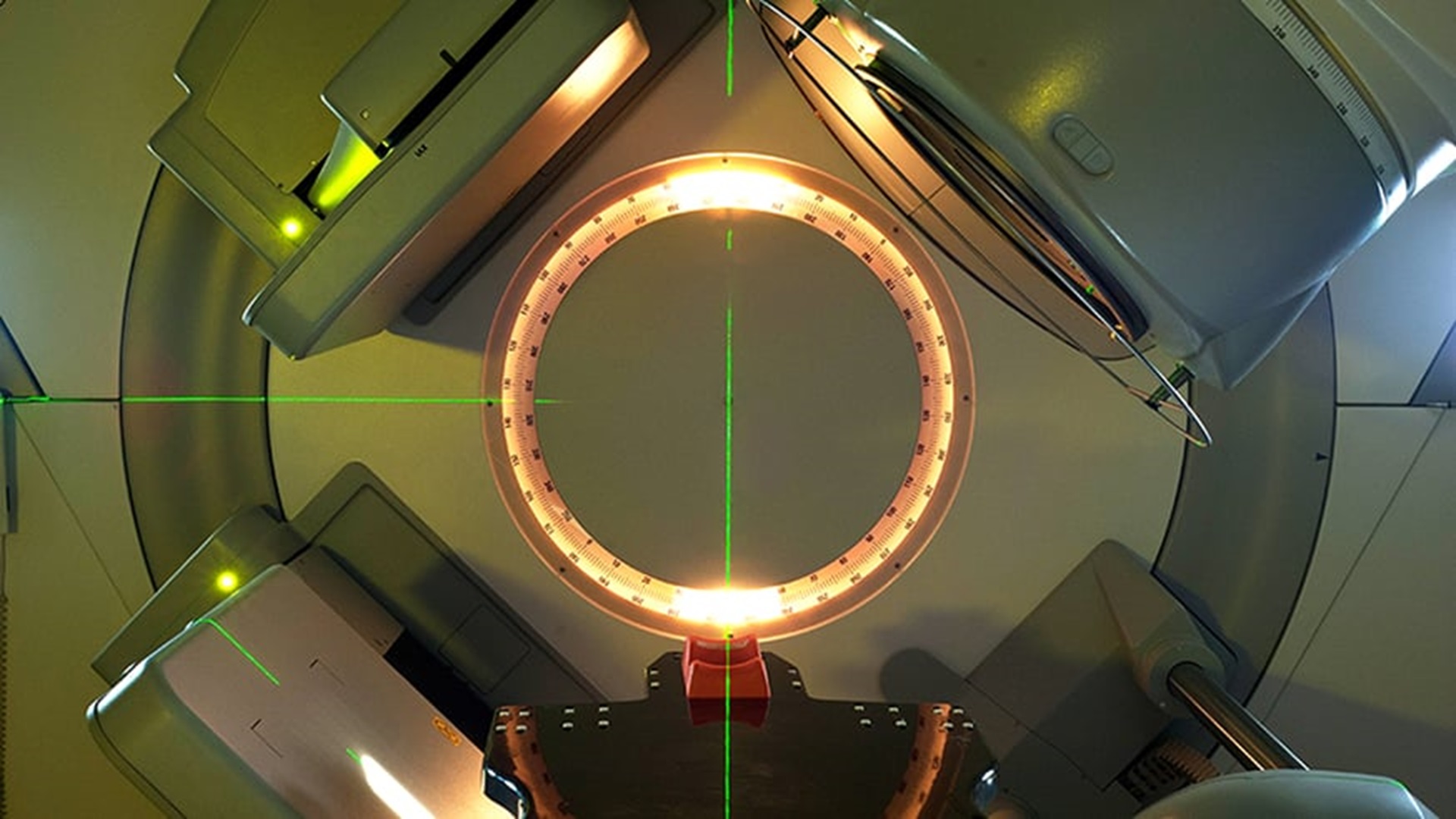 Radiotherapy IMRT Jan Chlebik/the ICR