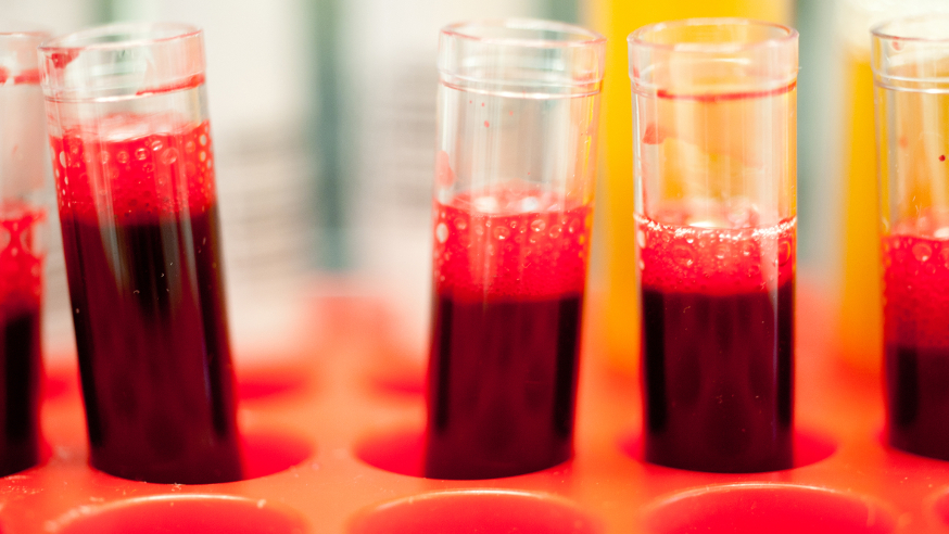 Blood samples in tubes 874x492 Blood samples in tubes