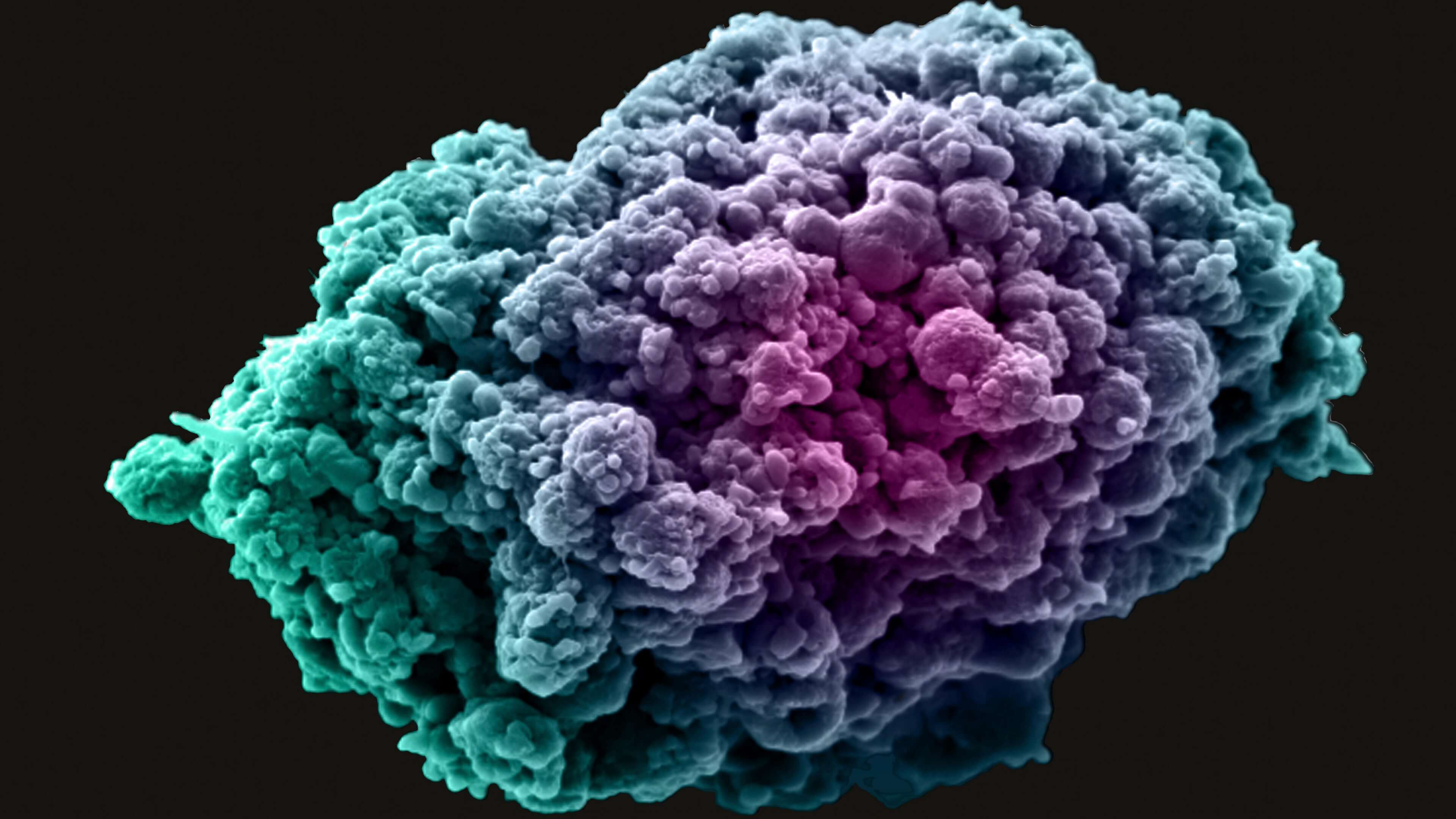 Breast cancer cell spheroid,840 x 2160 Breast cancer cell spheroid blue and purple