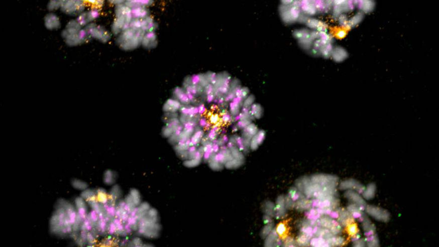 Cancer cell 874x492 Cancer cells
