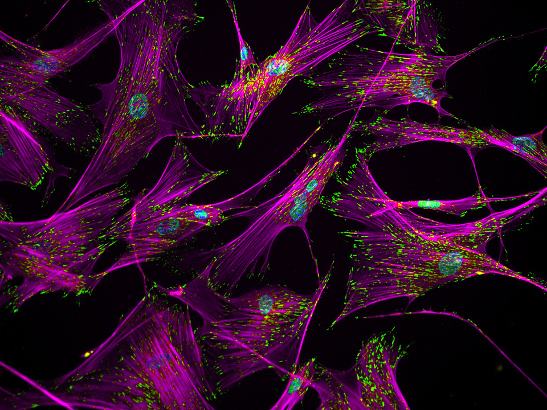 Fibroblasts - Ankur Singh, Georgia Tech Fibroblasts - Ankur Singh, Georgia Tech