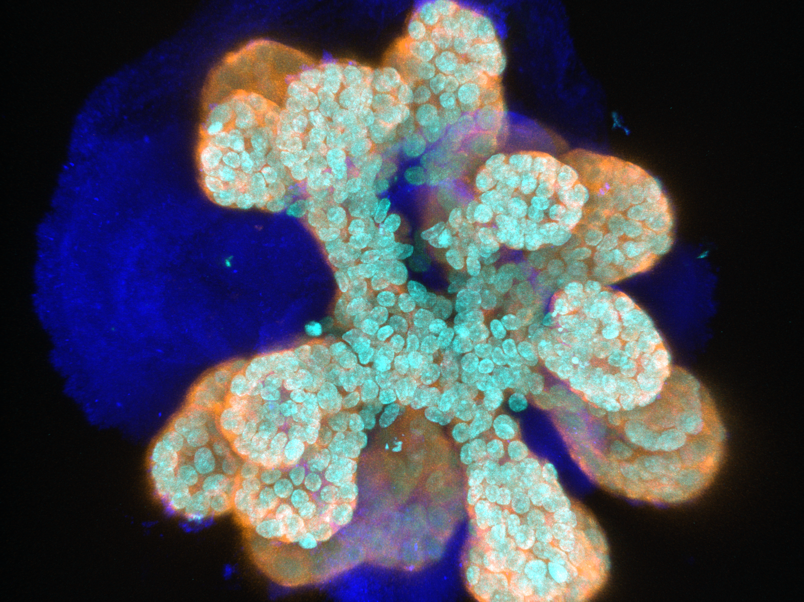 J_Almagro_mammary_organoid 4-3 Mammary organoid