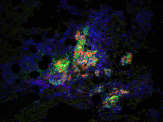 Johann de Bono and Mateus Crespo Prostate cancer cells 547x410 Johann de Bono and Mateus Crespo Prostate cancer cells 547x410