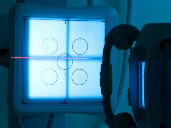 Radiotherapy 547x410