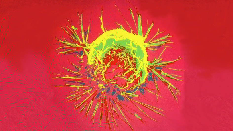 Celleba of Breast Cancer